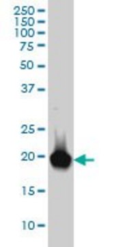 Monoclonal Anti-RBP4, (C-terminal) antibody produced