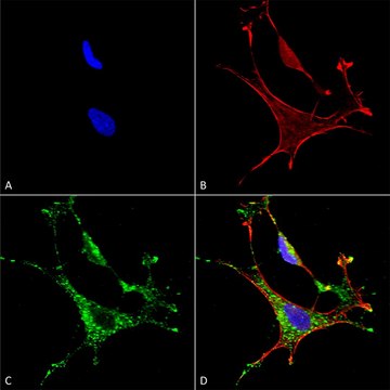Monoclonal Anti-Copper Transporting Atpase 1