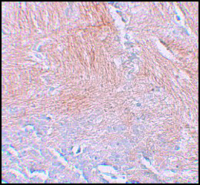 Anti-CXXC5 antibody produced in rabbit