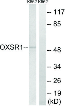 Anti-OXSR1 antibody produced in rabbit