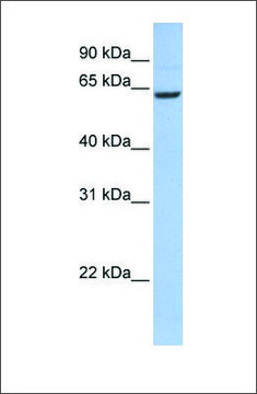 Anti-CCDC67 antibody produced in rabbit