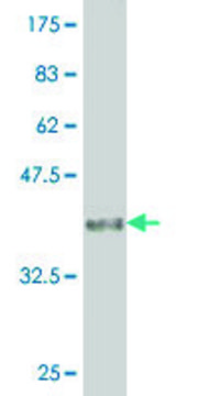 Monoclonal Anti-CER1 antibody produced in