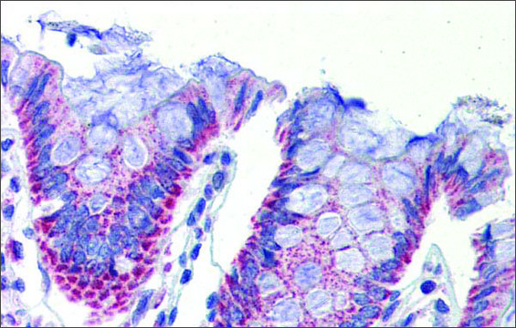 Anti-IMPDH1 antibody produced in rabbit
