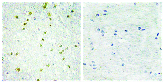 Anti-SNAPC5 antibody produced in rabbit