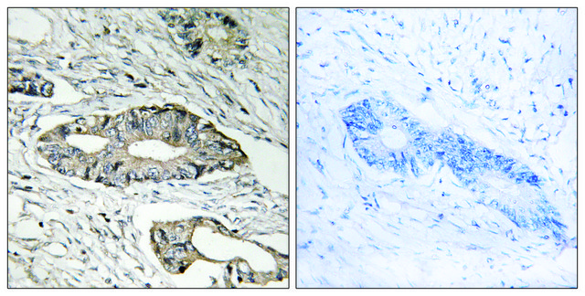 Anti-EPN3 antibody produced in rabbit