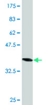 Monoclonal Anti-AHCYL1, (N-terminal) antibody produced