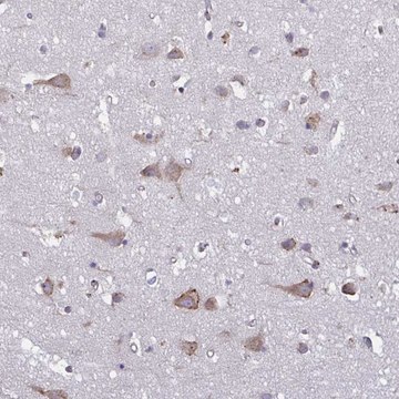 Anti-TMEM8C antibody produced in rabbit