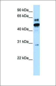 Anti-ESRRA antibody produced in rabbit
