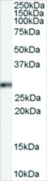 Anti-Homeobox B13 antibody produced in
