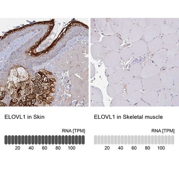 Anti-ELOVL1 antibody produced in rabbit