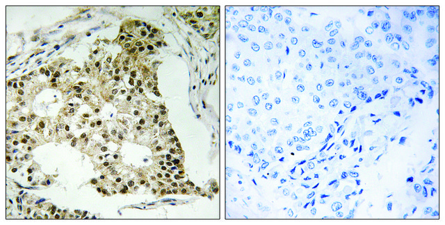 Anti-Retinoic Acid Receptor A (Phospho-SER77)