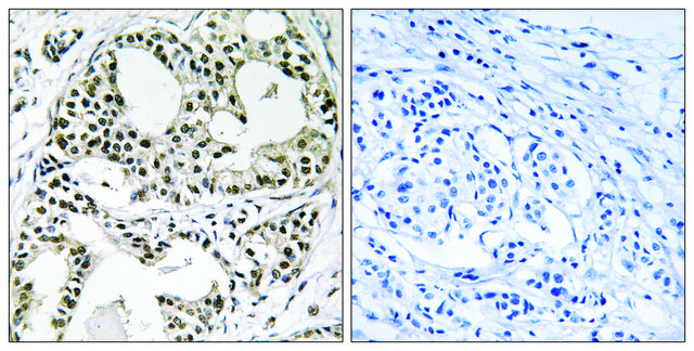 Anti-YEATS2 antibody produced in rabbit