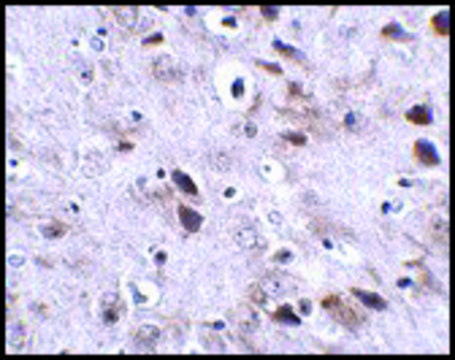 Anti-TMEM18 antibody produced in rabbit