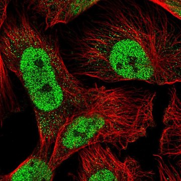 Anti-RAD23A antibody produced in rabbit
