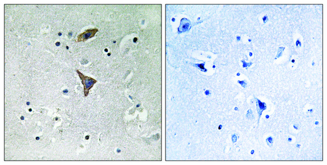 Anti-KCNT1 antibody produced in rabbit