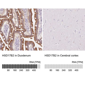 Anti-HSD17B2 antibody produced in rabbit
