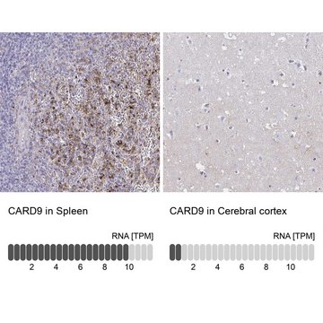Anti-CARD9 antibody produced in rabbit