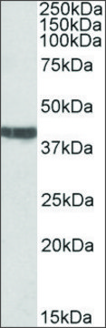Anti-TNNT2 (C-terminal) antibody produced in