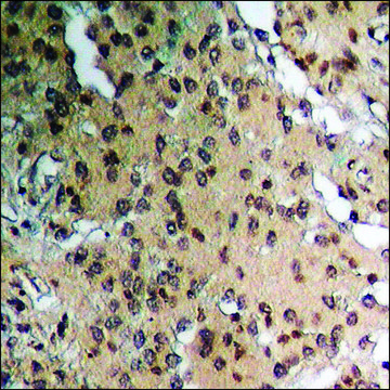 Anti-phospho-HER2 (pTyr???) antibody produced in