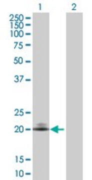 Anti-CD160 antibody produced in rabbit