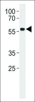 ANTI-P53 (S315) antibody produced in