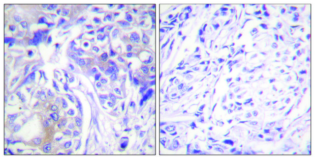 Anti-ADD1 antibody produced in rabbit