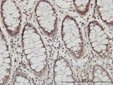 Monoclonal Anti-PSMB8 antibody produced in