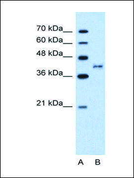 Anti-BDKRB2 antibody produced in rabbit