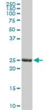 Anti-GSTA3 antibody produced in rabbit