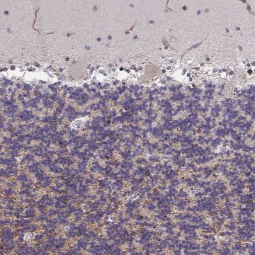 Anti-ZIC3 antibody produced in rabbit