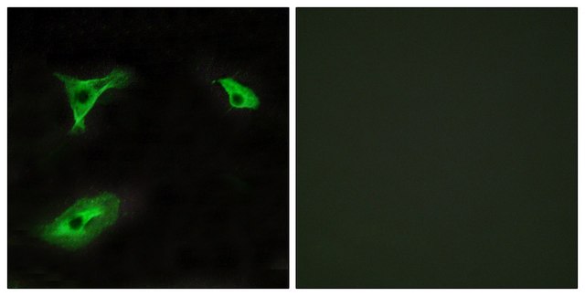 Anti-GPR116 antibody produced in rabbit