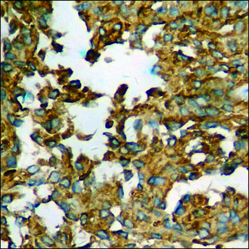 Anti-phospho-p53 (pSer³?) antibody produced in