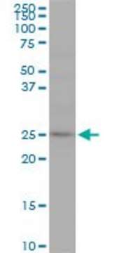 Monoclonal Anti-RAB7L1 antibody produced in