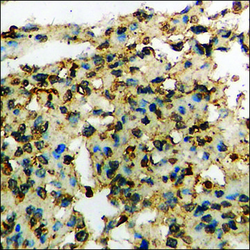 Anti-phospho-EPB41 (pTyr660/418) antibody produced in