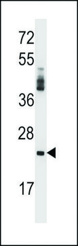 ANTI-PRSS2 (CENTER) antibody produced in