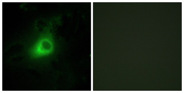 Anti-GRK6 antibody produced in rabbit