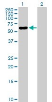 Anti-PNLIPRP2 antibody produced in rabbit