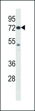 ANTI-MOUSE PAK4 (CENTER) antibody produced