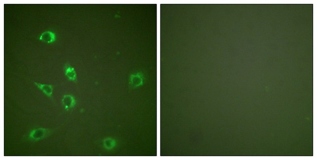 Anti-Glucagon antibody produced in rabbit