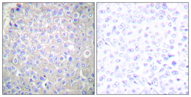 Anti-E-cadherin antibody produced in rabbit