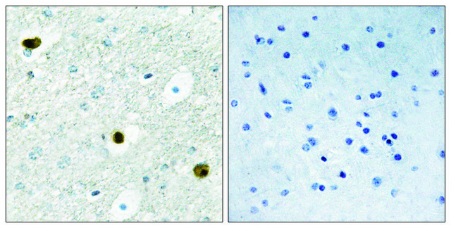 Anti-TPD52 antibody produced in rabbit
