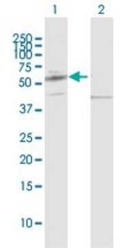 Anti-PPAT antibody produced in rabbit