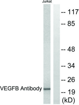 Anti-VEGFB antibody produced in rabbit
