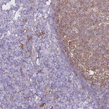 Anti-GNA11 antibody produced in rabbit