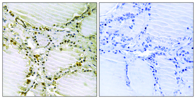 Anti-AMPD1 antibody produced in rabbit