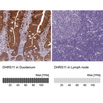 Anti-DHRS11 antibody produced in rabbit