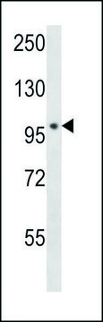 ANTI-POLN (C-TERM) antibody produced in