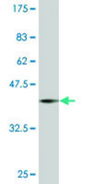 ANTI-PRDM1 antibody produced in mouse