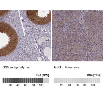 Anti-GSS antibody produced in rabbit