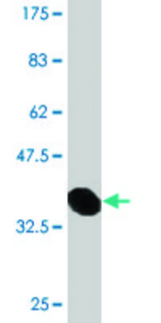 Monoclonal Anti-DEPDC1B, (C-terminal) antibody produced
